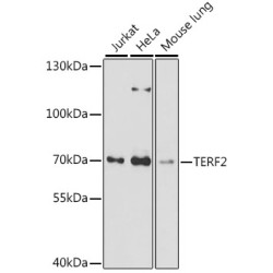 TERF2 Rabbit pAb