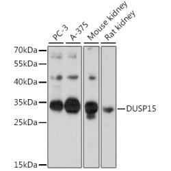DUSP15 Rabbit pAb