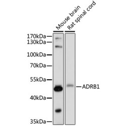 ADRB1 Rabbit pAb