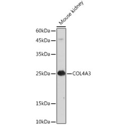 COL4A3 Rabbit pAb