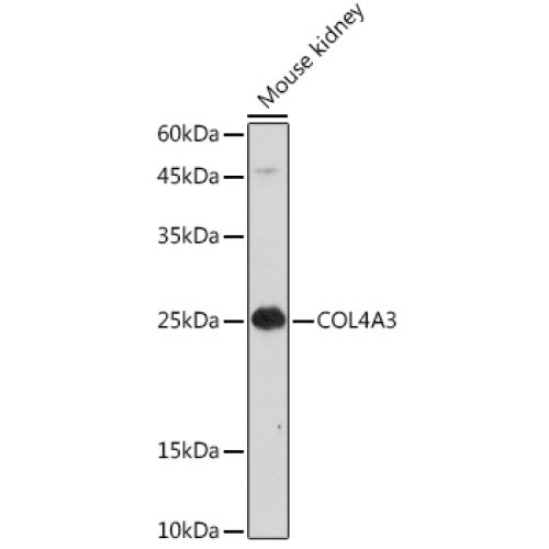 COL4A3 Rabbit pAb