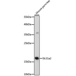 Slc31a2 Rabbit pAb