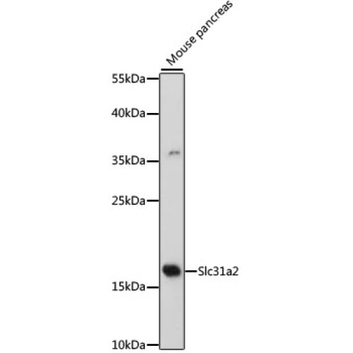 Slc31a2 Rabbit pAb