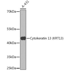 Cytokeratin 13 (KRT13) Rabbit pAb