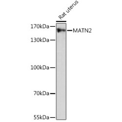 MATN2 Rabbit pAb