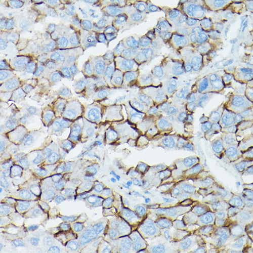 δ-Catenin/p120 Catenin Rabbit pAb