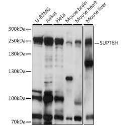 SUPT6H Rabbit pAb