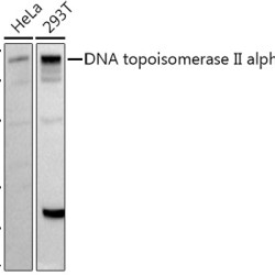 DNA topoisomerase II alpha (TOP2A) Rabbit pAb
