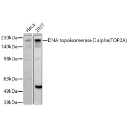 DNA topoisomerase II alpha (TOP2A) Rabbit pAb