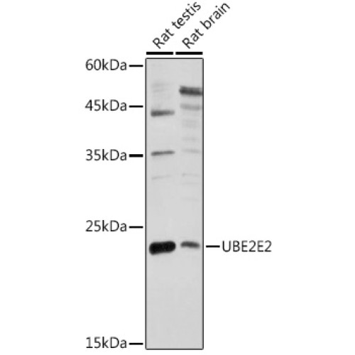 UBE2E2 Rabbit pAb