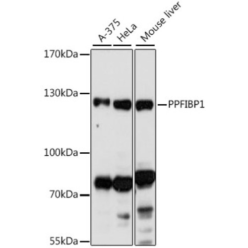 PPFIBP1 Rabbit pAb