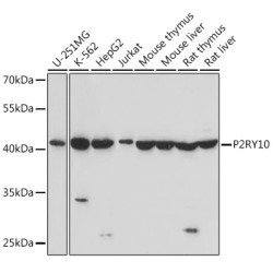 P2RY10 Rabbit pAb