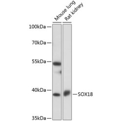 SOX18 Rabbit pAb