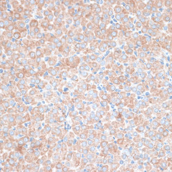 PMEPA1 Rabbit pAb