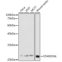 STARD3NL Rabbit pAb