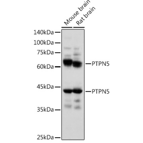 PTPN5 Rabbit pAb