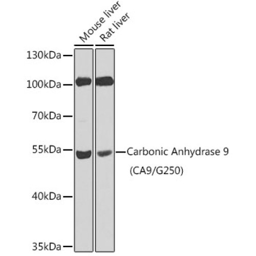 Carbonic Anhydrase 9 (CA9/G250) Rabbit pAb