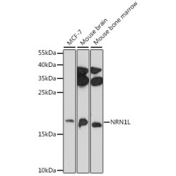NRN1L Rabbit pAb