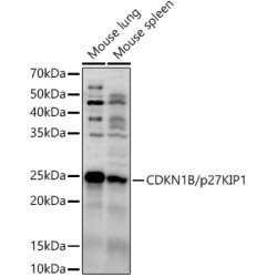 CDKN1B/p27KIP1 Rabbit pAb