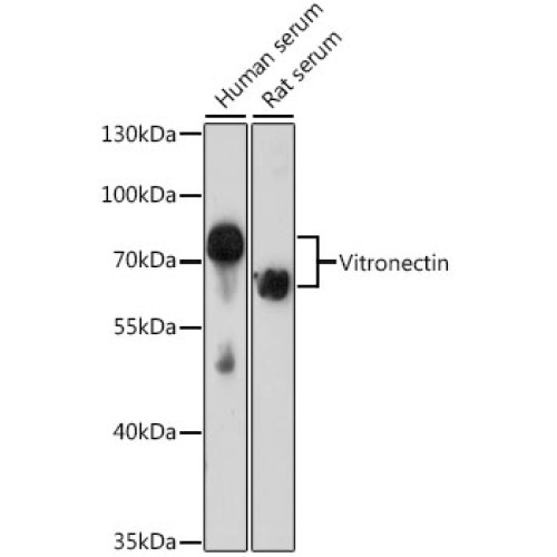 Vitronectin Rabbit pAb