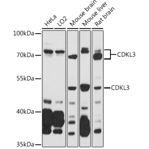 CDKL3 Rabbit pAb