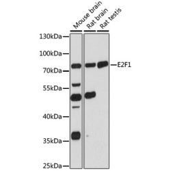 E2F1 Rabbit pAb