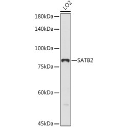 SATB2 Rabbit pAb
