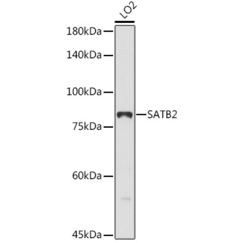 SATB2 Rabbit pAb