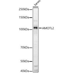 AMOTL2 Rabbit pAb