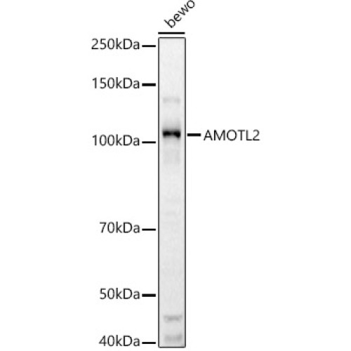 AMOTL2 Rabbit pAb