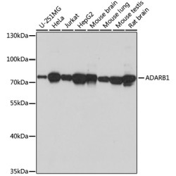 ADARB1 Rabbit pAb