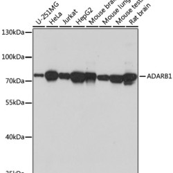 ADARB1 Rabbit pAb