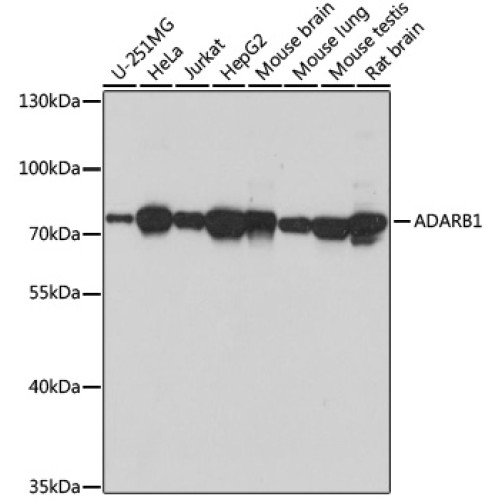 ADARB1 Rabbit pAb