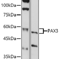 PAX3 Rabbit pAb
