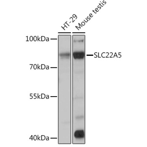 SLC22A5 Rabbit pAb