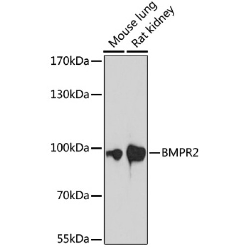 BMPR2 Rabbit pAb