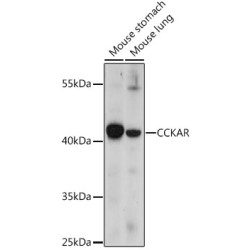CCKAR Rabbit pAb