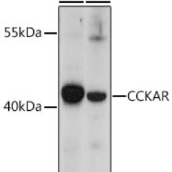 CCKAR Rabbit pAb
