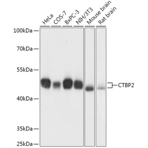 CTBP2 Rabbit pAb
