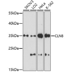 CLN8 Rabbit pAb