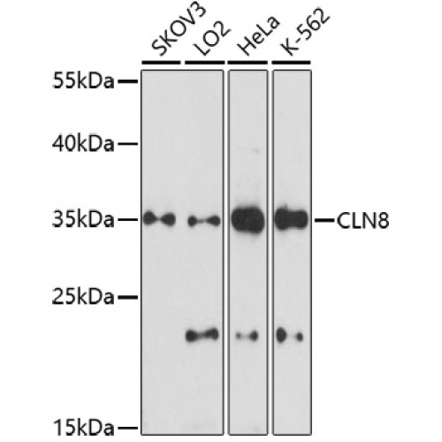 CLN8 Rabbit pAb