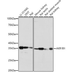 AKR1B1 Rabbit pAb