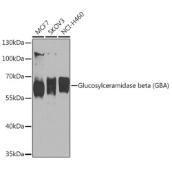 Glucosylceramidase beta (GBA) Rabbit pAb