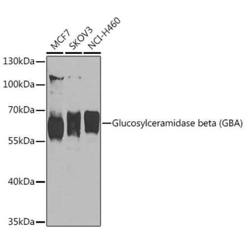 Glucosylceramidase beta (GBA) Rabbit pAb