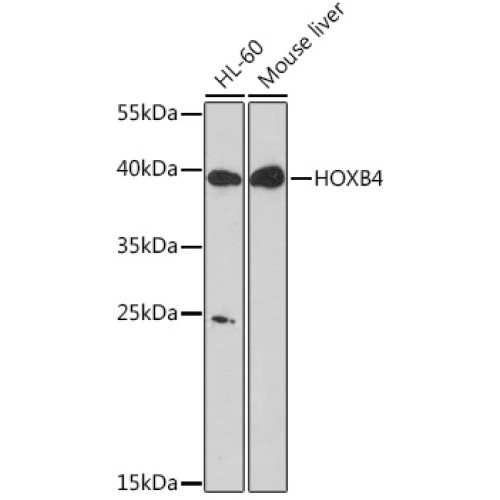 HOXB4 Rabbit pAb