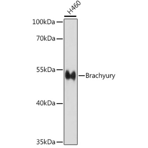 Brachyury Rabbit pAb