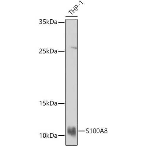 S100A8 Rabbit pAb