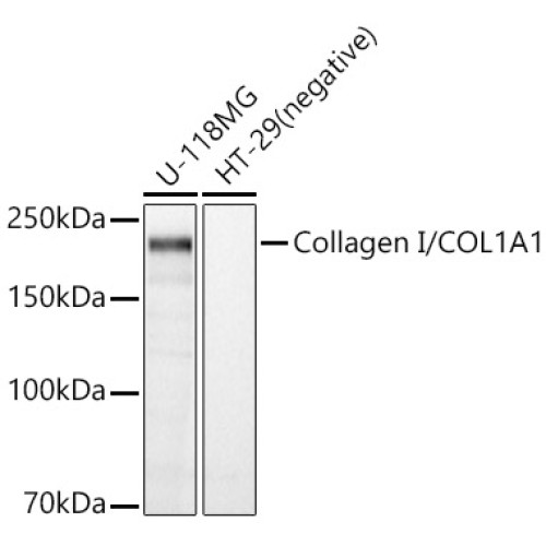 Collagen I/COL1A1 Rabbit pAb