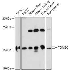 TOM20 Rabbit pAb