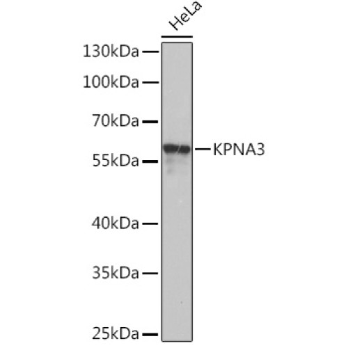 KPNA3 Rabbit pAb